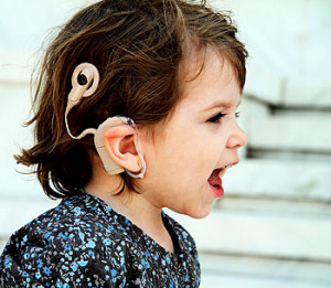 Cochlear implants: What, Why, When, How?