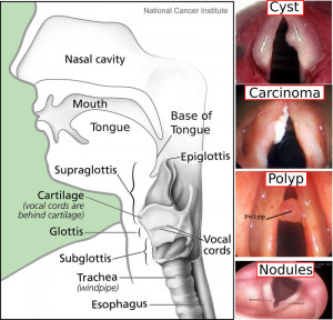 Different Voice Disorders