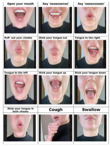 Jaw exercises