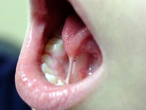 tongue movements